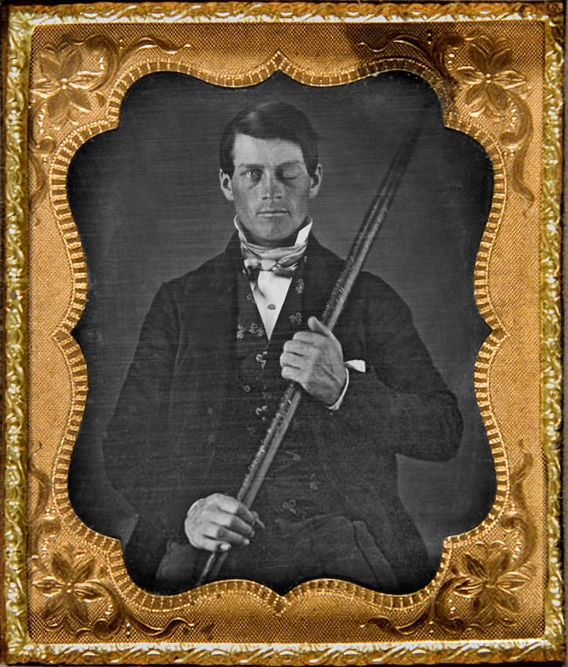 Daguerrotipo antiguo en un marco dorado: Phineas Gage, con un ojo cerrado, sostiene la larga barra de hierro que le atravesó la cabeza